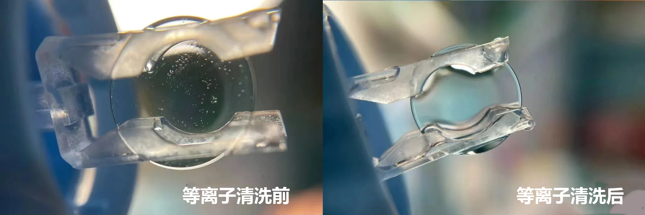 角膜塑形镜（OK镜）等离子清洗技术的应用